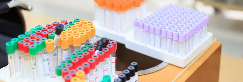 环氧脂肪酸甲酯检测