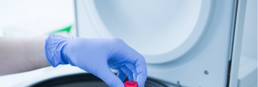 塑料阻燃抗冲击聚苯乙烯专用料检测