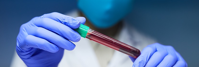 2,4-二叔丁基苯酚检测